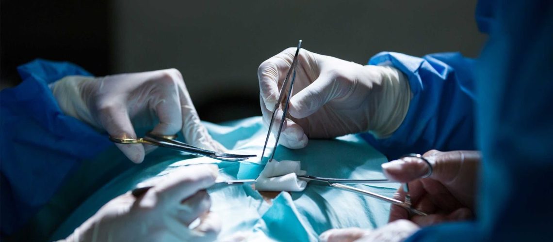 ختنه در بزرگسالان