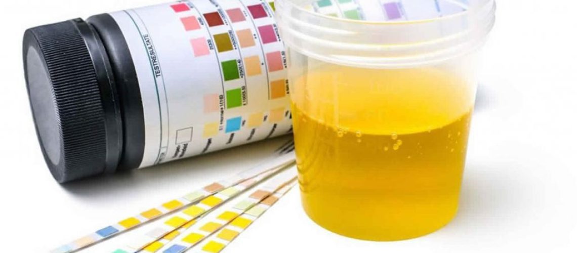 دفع پروتئین